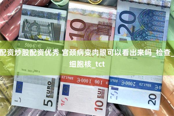 配资炒股配资优秀 宫颈病变肉眼可以看出来吗_检查_细胞核_tct